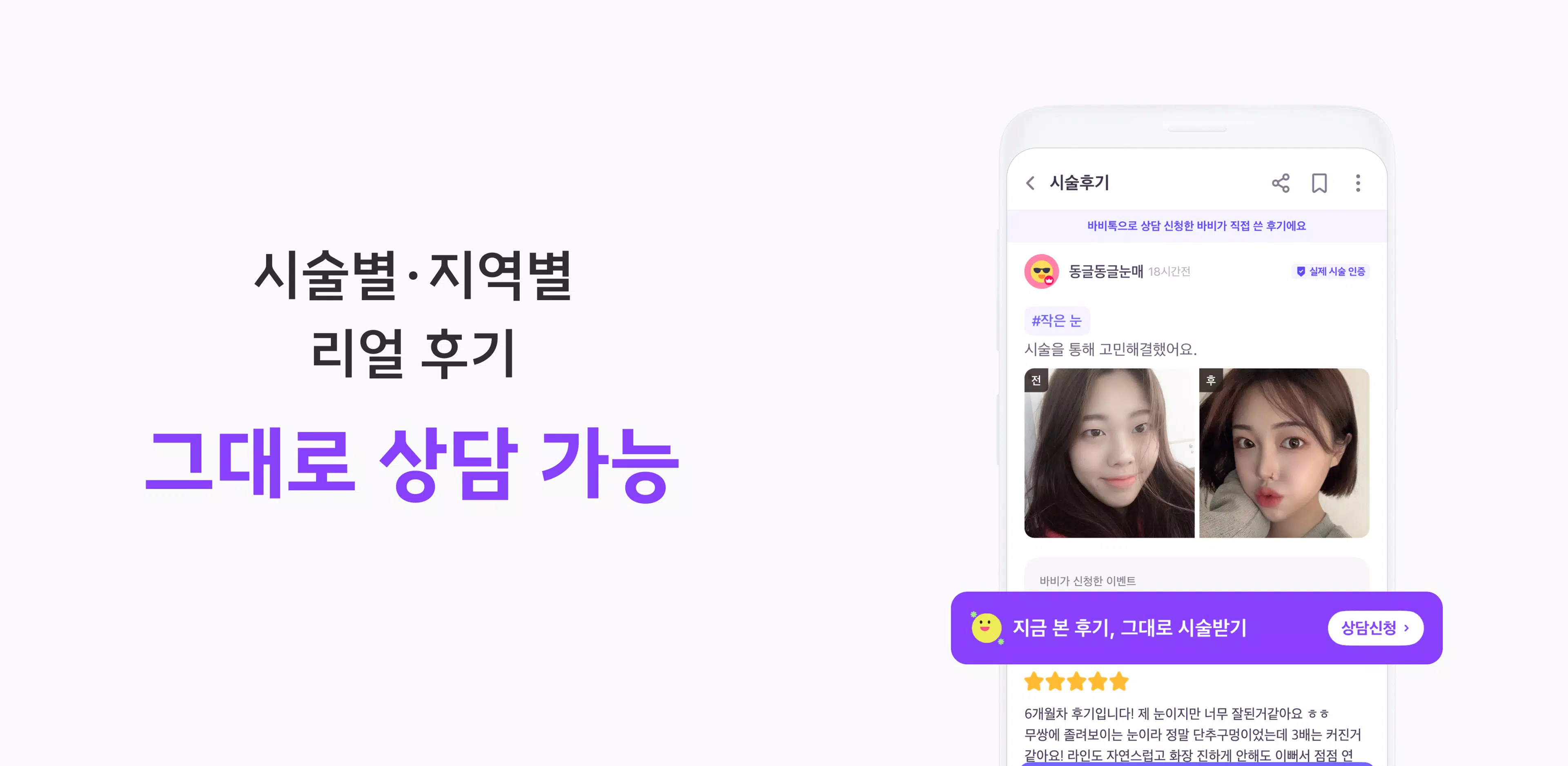 Screenshot 바비톡 - 성형 시술 성형외과 피부과 병원예약 성형어플 2