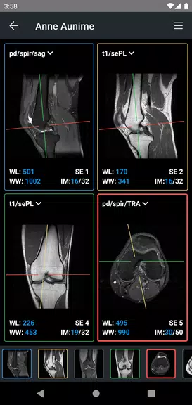 IDV - IMAIOS DICOM Viewer屏幕截圖2