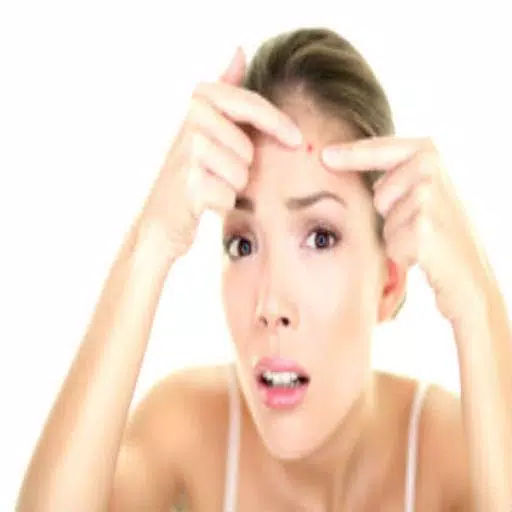 Get Rid of Acne  (Guide) captura de pantalla 0