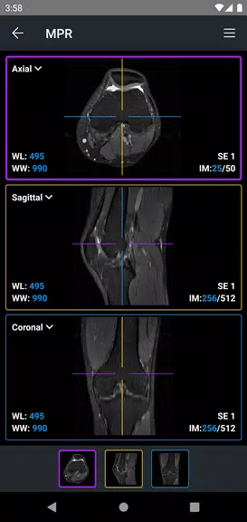 IDV - IMAIOS DICOM Viewer экрана 3