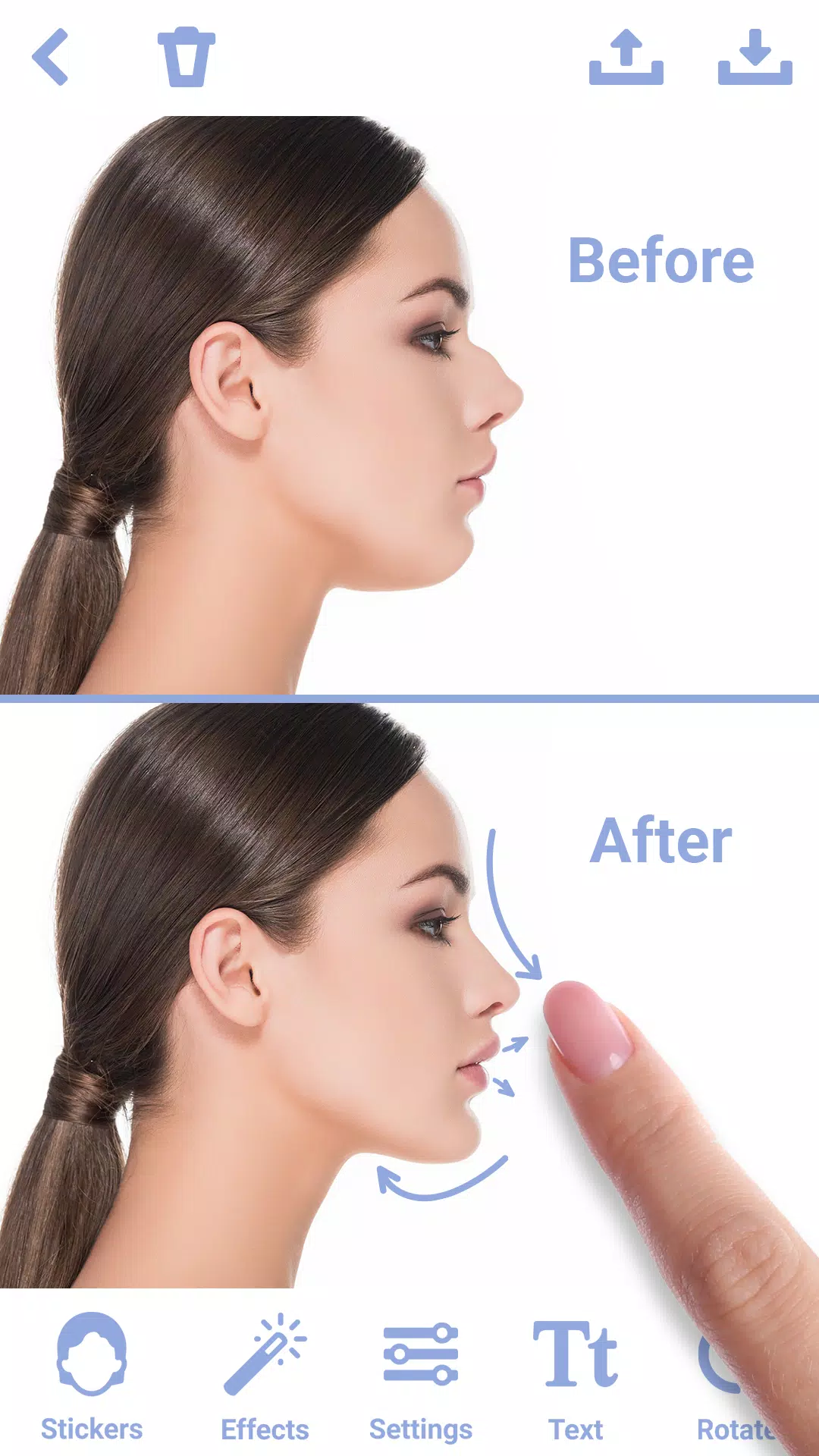 Rhinoplasty ảnh chụp màn hình 0