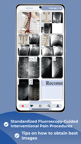 Interventional Pain App Captura de tela 2